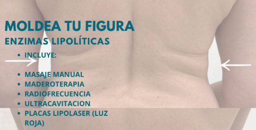 Tratamientos Corporales