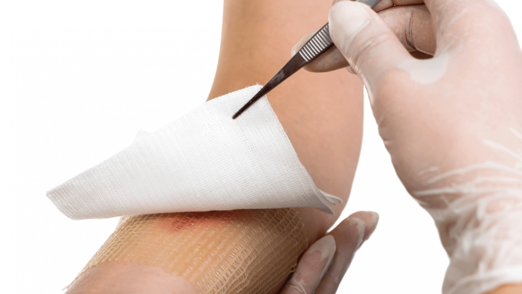 Curaciones Profesionales de Heridas
