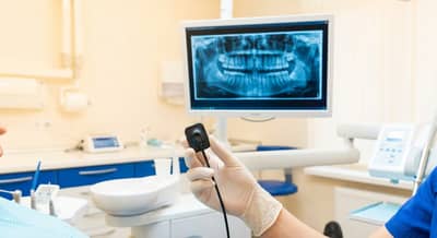 Radiografias Dentales