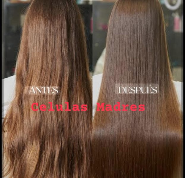 Celulas Madres Capilar