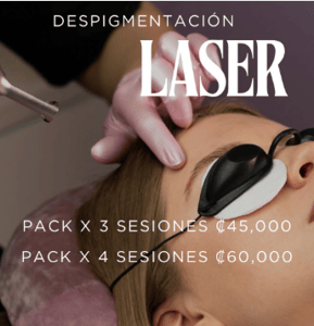 Eliminacion de tatuajes 