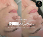 Tratamientos estetico de ADN