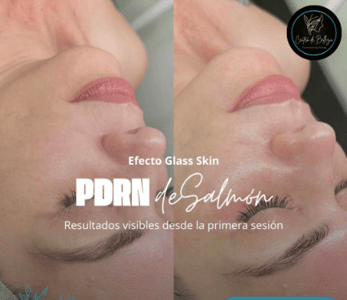 Tratamientos estetico de ADN